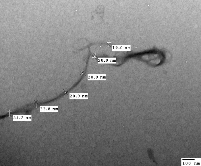 Nanofibrils of Bacterial Cellulose by Acetobacter xylinum (TEM image)